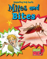 Mites_and_bites