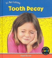 Tooth_decay