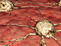Fighting_Skin_Cancer_and_Brain_Tumors_with_New_Methods